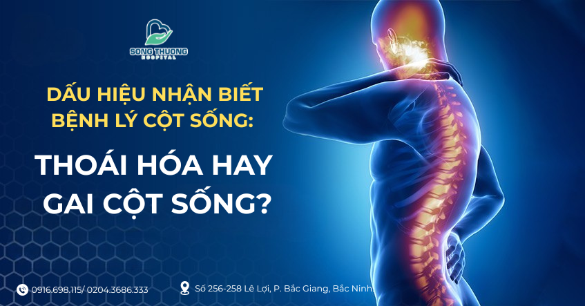DẤU HIỆU NHẬN BIẾT BỆNH LÝ CỘT SỐNG: THOÁI HÓA HAY GAI CỘT SỐNG?